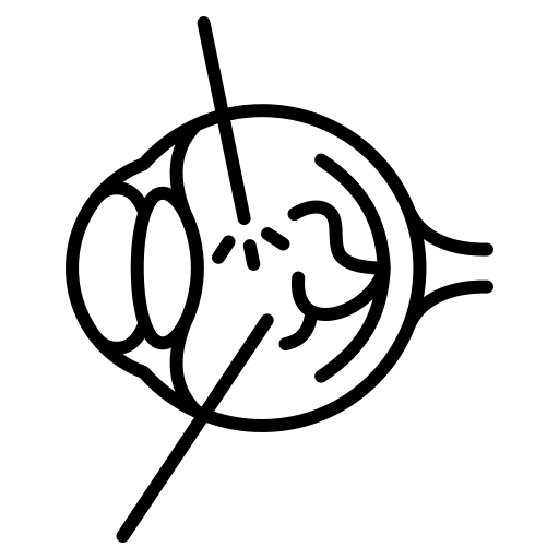 Laporan automatik